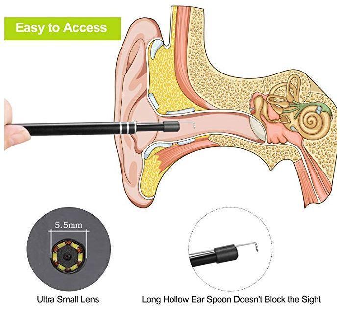 2-in-1 Ear Cleaner with HD Camera